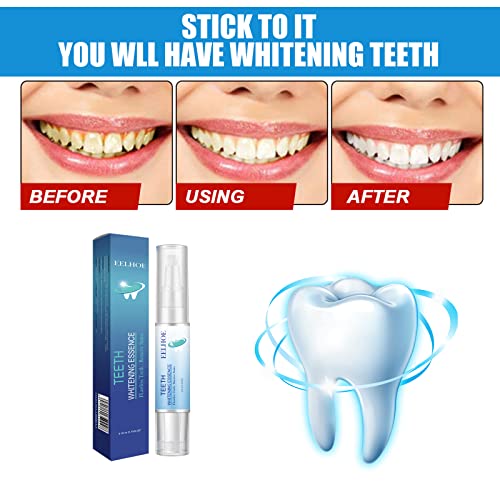 Суштината на белење на забите, пенкалото за белење на забите, комплет за белење на забите, најдобри производи за белење на забите, интензивни заби