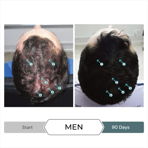 Спектрално.Ухп И Спектрал.Ф7 Пакет За Поддршка На Растот на Косата Кај Мажите Од Лабораториите НА ДС