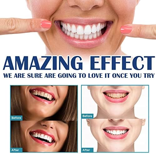 Белење на заби од 15 мл, природно чистење на устата ги отстранува дамките на плаките заби заби