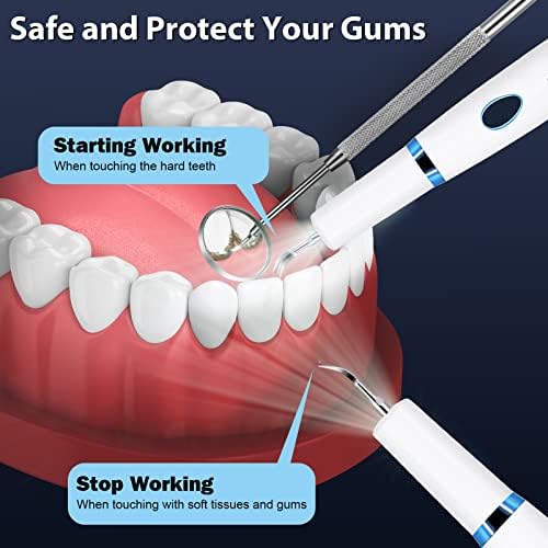 Отстранувач на плаки за заби, електрични заби за чистење на заби, отстранувач на плакета и калкулус, дамка и забен камен за заби