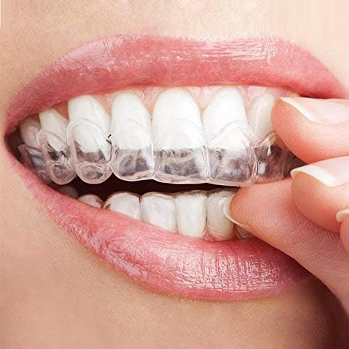 Бела стоматолошка убавина 16% карбамид пероксид нане заби за белење на заби, 2- 3мл шприцови, 1 пакет, споредено со опалесценција, драматично