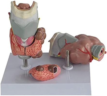 Model Model Model, Model Thyroid Pathology Moang, го зголеми човечкиот тироиден тироиден тироид заболен анатомија модел на човечки