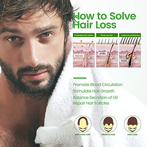 Серум За Раст на косата, Превенција Од Губење На Косата И Третман За Задебелување На Косата За Мажи И Жени, Напредна Формула За Раст На Косата