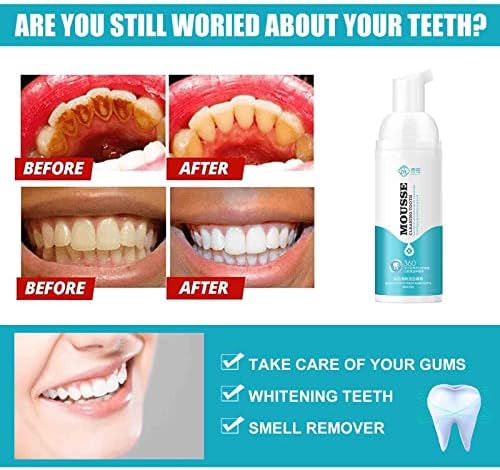 Прекрасна бела насмевка - Белење на заби за заби за заби за заби, паста за заби Отстранувањето Намалување на пожолтувањето на алатките,