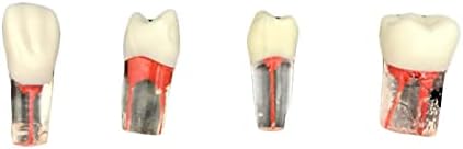 Коренските канали KH66ZKY со пулпа шуплина - стоматолошки модел - Модел на заби за учење деца или тест за орална вештина, 5 компјутери