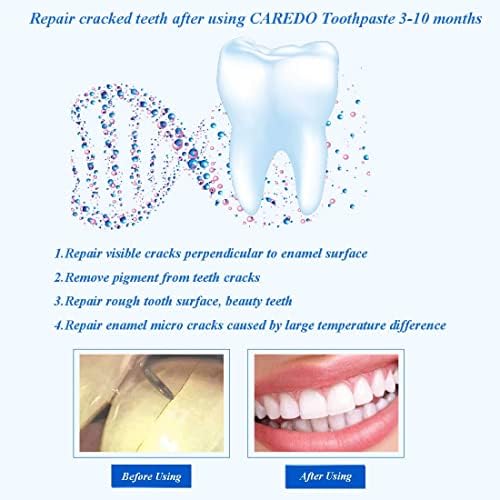 Caredo заздравување на забите пукнатина паста за заби, единствената паста за заби што ги поправа испуканите пукнатини на емајл на забите, лечи чувствителност на забит