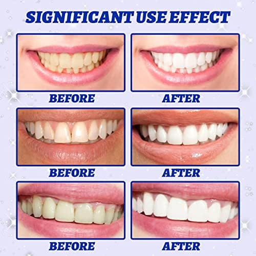 Икас 7 парчиња ленти за белење на заби, не-чувствителни заби за заби за заби за заби за заби за белење на заби за белење на заби, помагала во отстранувањето на пушењет
