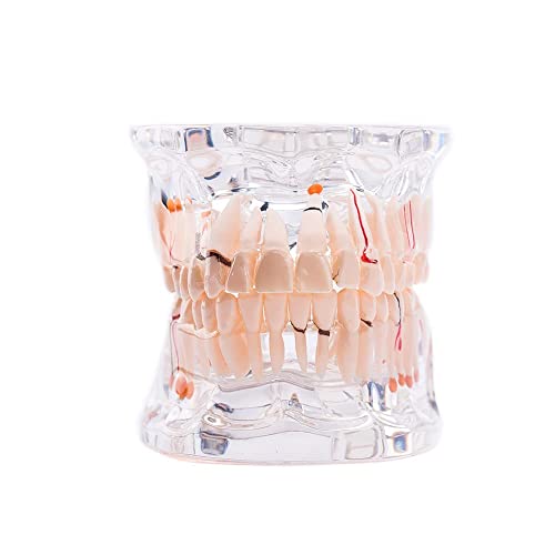 Транспарентен модел на заби за заби за заби, модел на настава за стандарден патологија