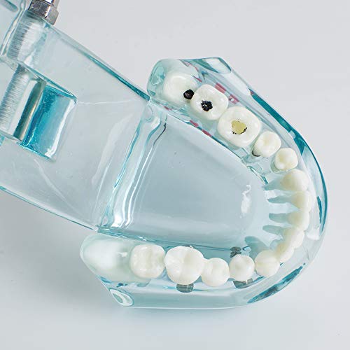 Denshine Нова стоматолошка студија Транспарентен модел на заби за возрасни заби