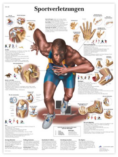 3B Scientific VR0188UU сјајно хартија Sportverletzungen Anatomical Chart, големина на постер 20 ширина x 26 Висина