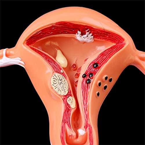 Vexigo Човечки патолошки матка модел на јајници, анатомски модел на жени репродуктивни органи Анатомски дел од алатката за учење, учење, прикажување