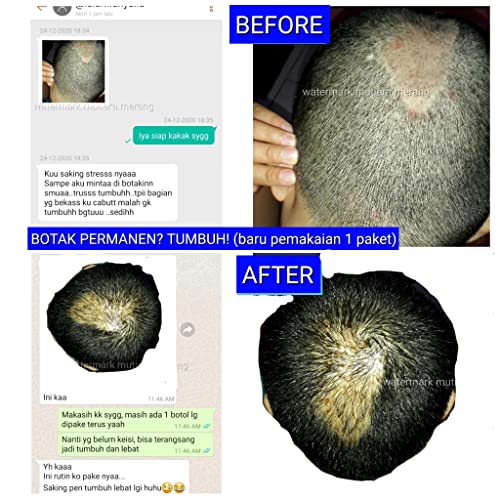 Индонезиско-Бали Раст На Косата во 2 недели Загарантирана Природно Со Печени Свеќа &засилувач; кокосово Масло анти коса