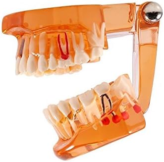 Д -р. Модел на бели заби портокалова, транспарентна болест на заби за заби