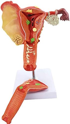 Модел на настава RRGJ, модел на матка, модел на анатомско зголемување на јајниците на матката за медицинска настава Анатомија Анатомија биологија