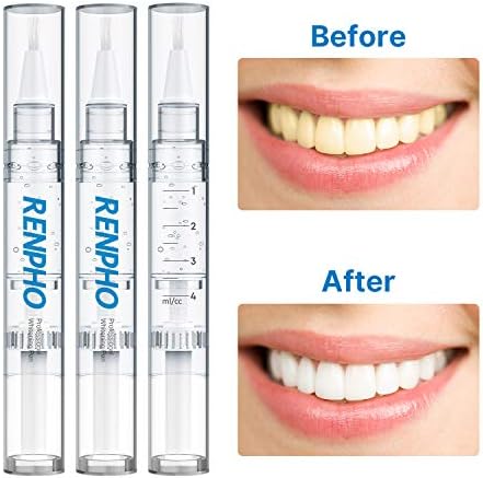 Ренфо заби Белење пенкала 3 пакет, професионален гел за белење на заби за чувствителни заби, 35% карбамид пероксид, без чувствителност, безболна, лесна за употреба, 20+?
