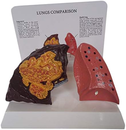 Модел на човечки респираторни систем KH66ZKY - Модел на анатомија на белите дробови - Пушење на белите дробови и нормалните модели на споредба