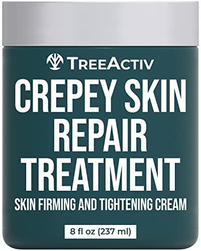 Трејтвив Крепеј Третман за поправка на кожата, 8oz, зацврстувајќи крем крем за кожа со хијалуронска киселина и путер од шеа за длабоко навлажнување и затегнување на ?